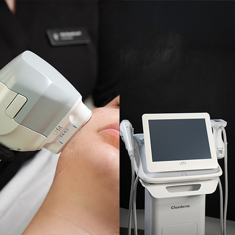 SMAS-Lifting HIFU